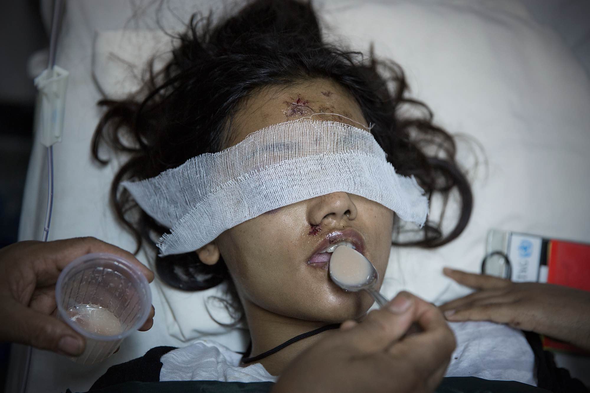 A young woman with a head injury is spoon fed at a hospital in Kathmandu, Nepal on May 1, 2015.